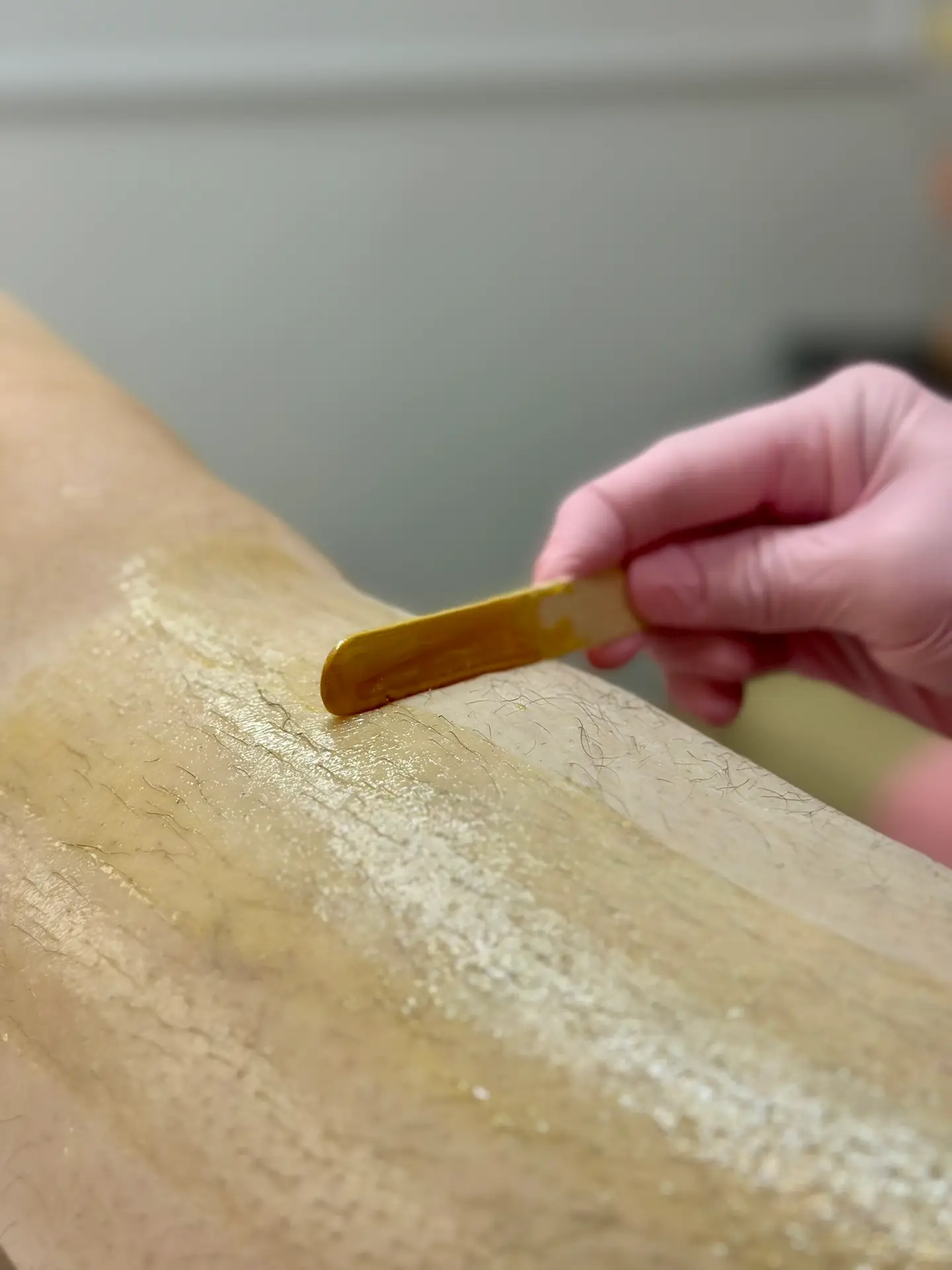 perna de uma mulher passando pelo processo de depilação na Modena CliniQ