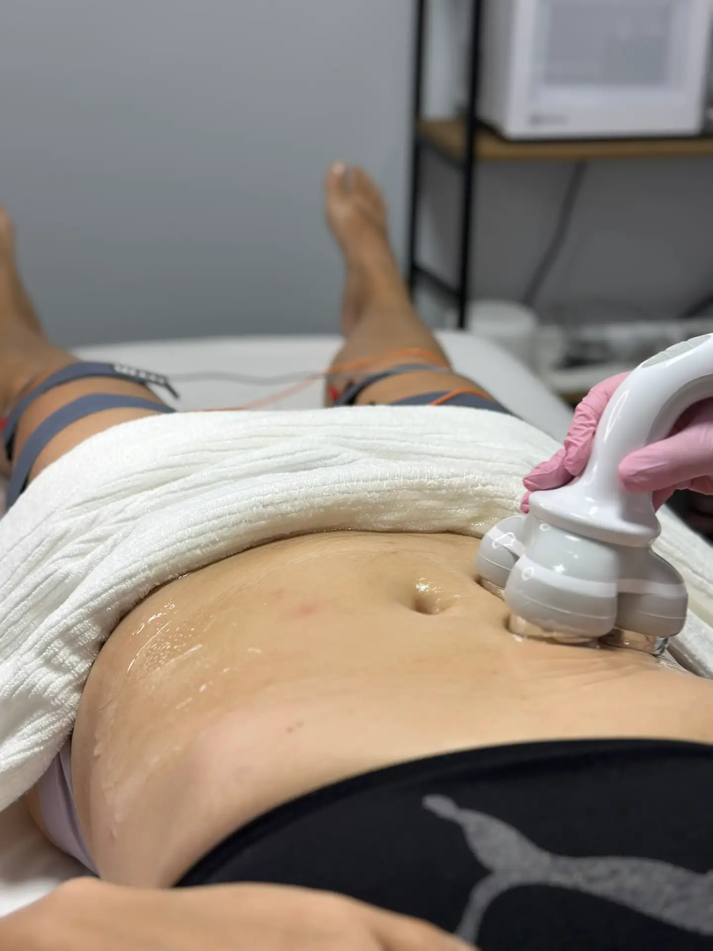 profissional aplicando ultrassom no abdômen da paciente para tratamento de gordura localizada e flacidez na Modena CliniQ